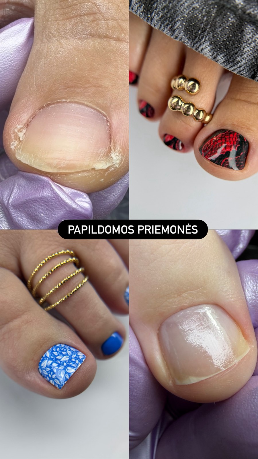 Kitos priemonės